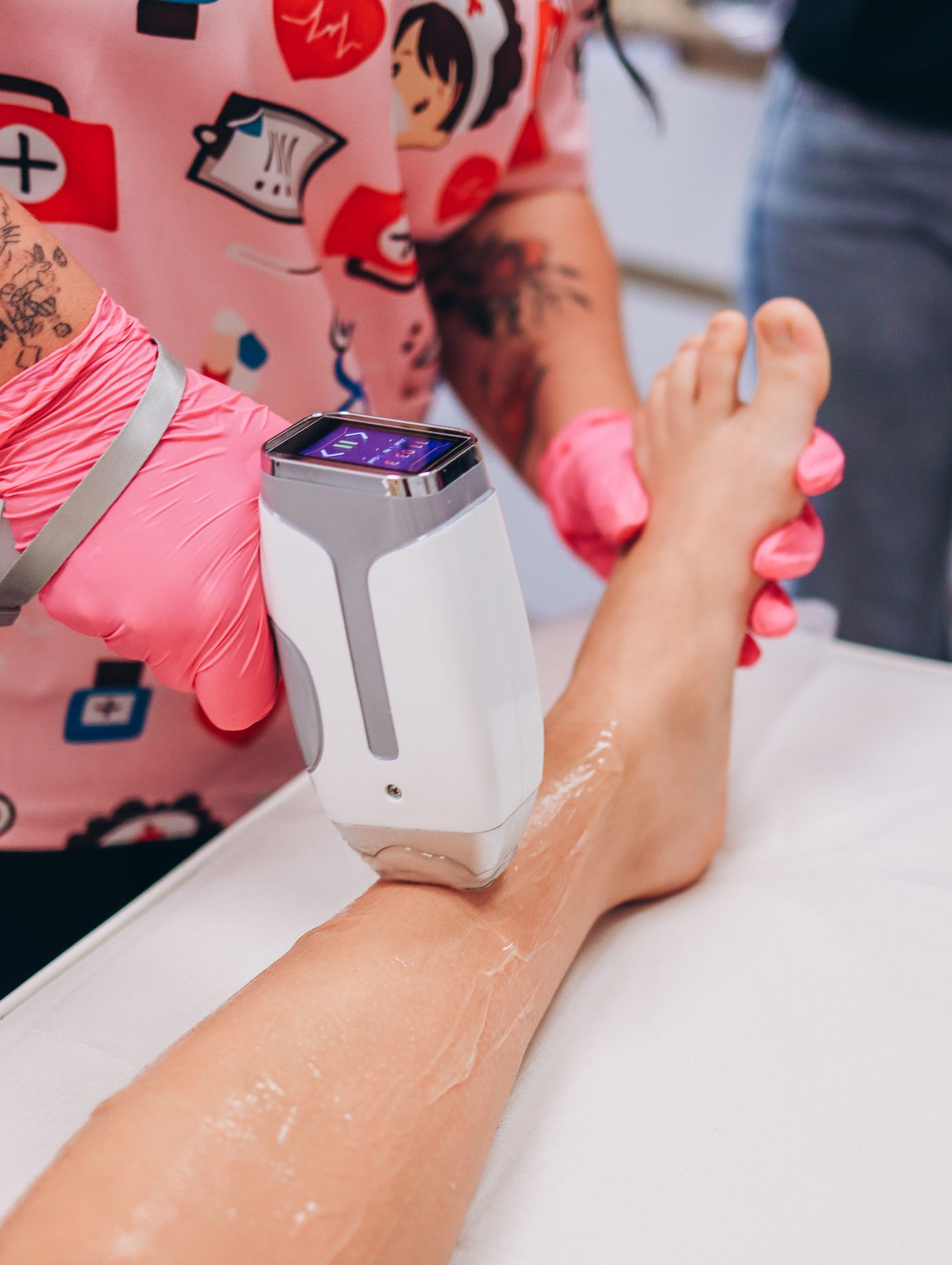Chuyên viên thực hiện liệu trình triệt lông bằng laser